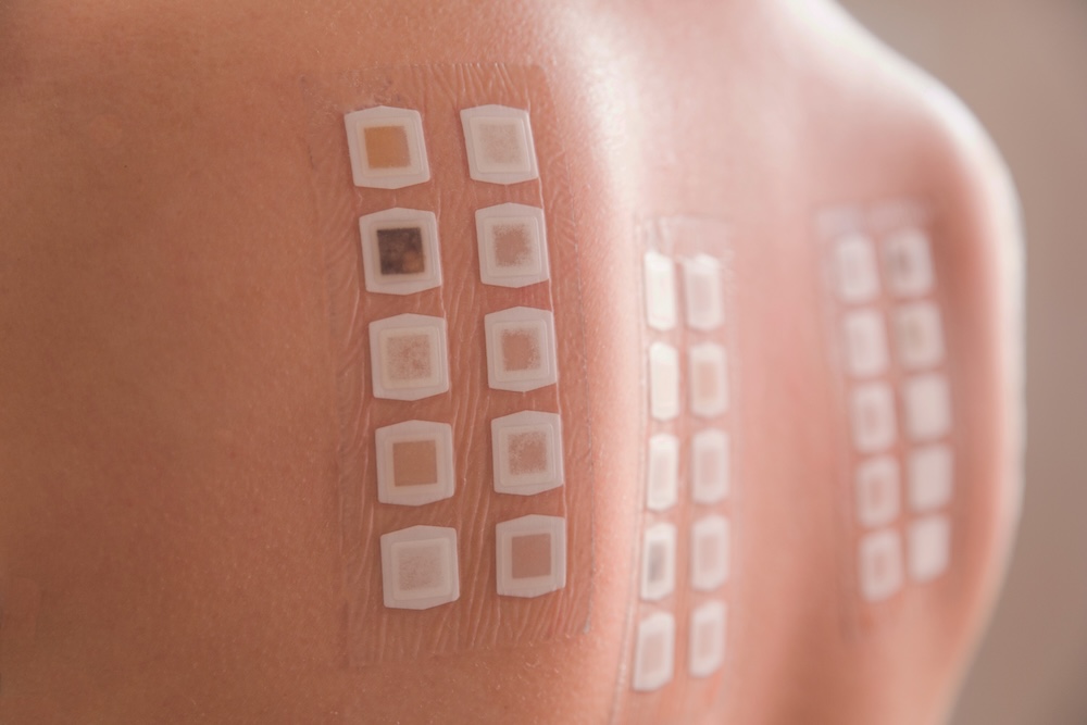Dermatological tests to detect certain types of allergies